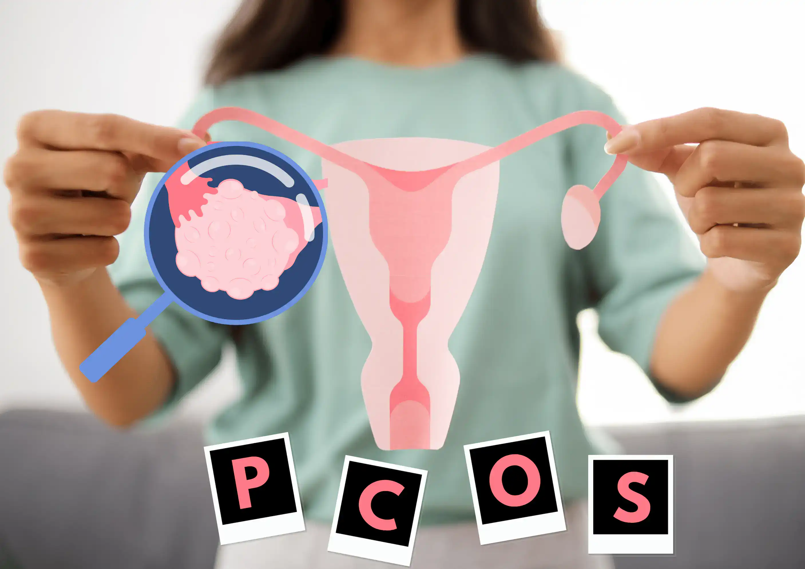 PMOS a PCOS