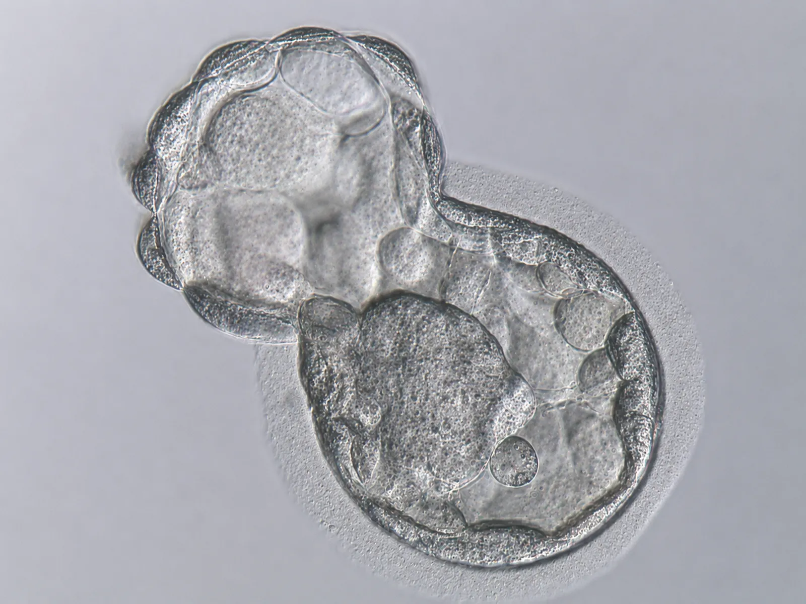 Asistovaný hatching