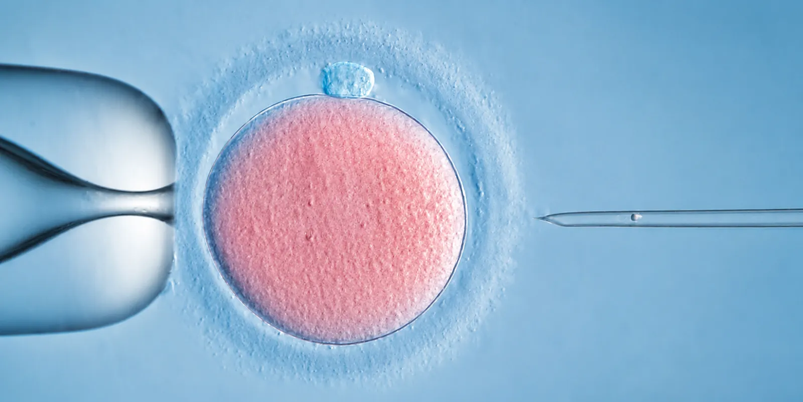 IVF léčba / umělé oplodnění